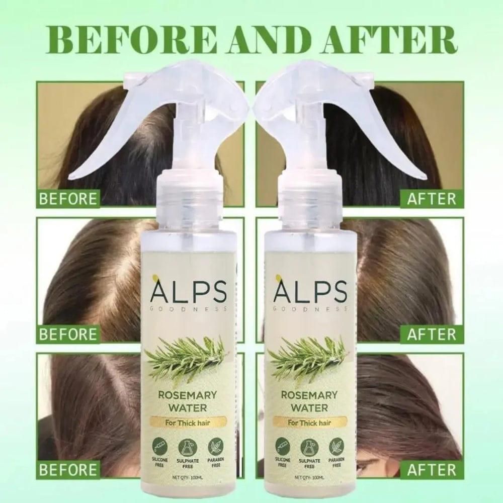 🌿 Rosemary Water, Hair Spray For Regrowth Buy 1 Get 2 Free