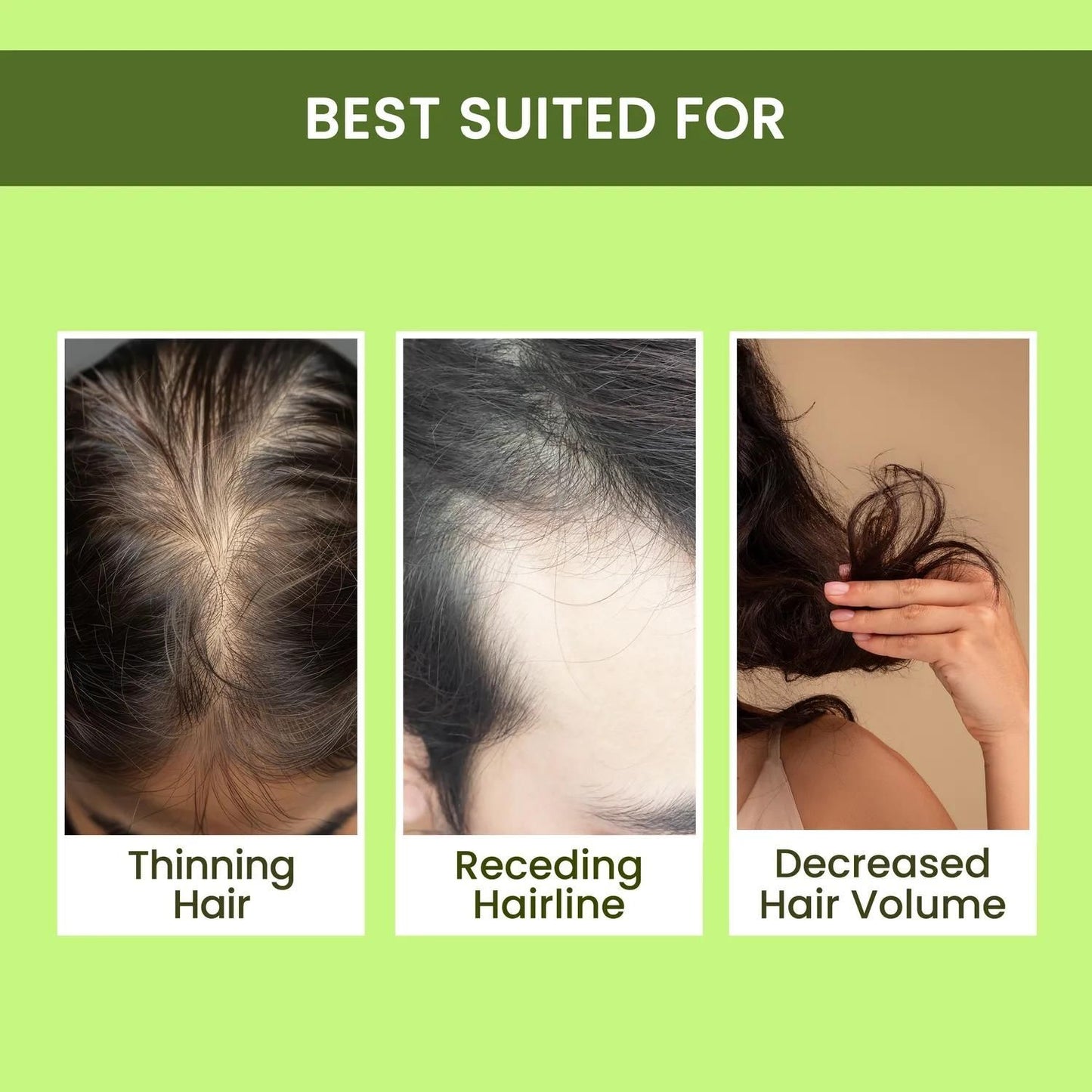 🌿 Rosemary Water, Hair Spray For Regrowth Buy 1 Get 2 Free