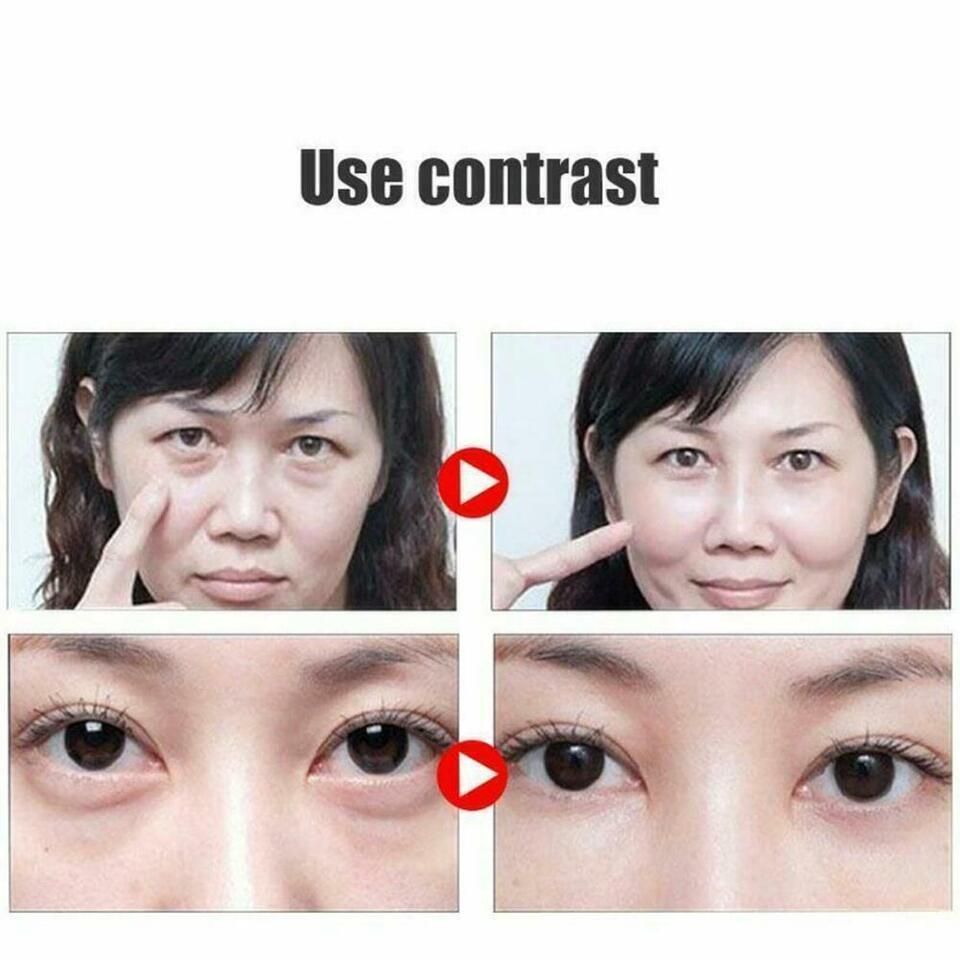 Remove Dark Circles 