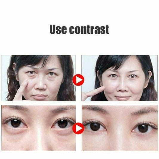 Remove Dark Circles 