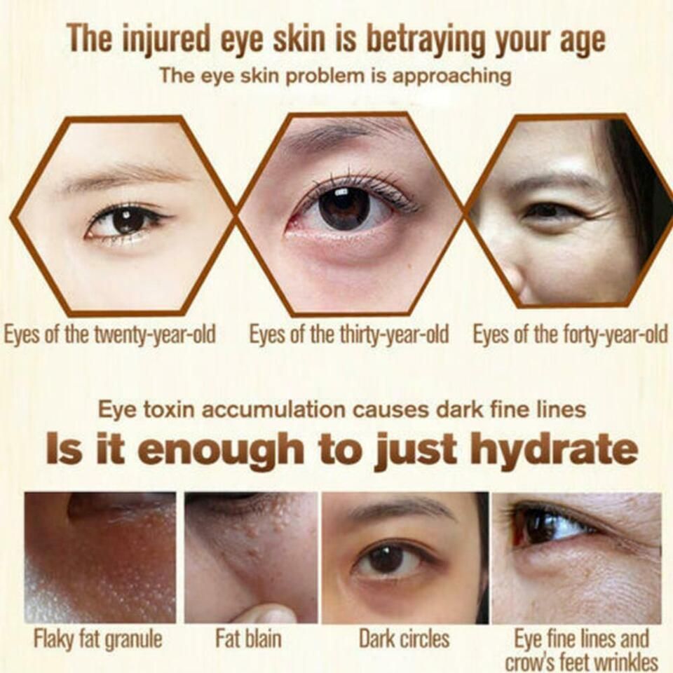 Remove Dark Circles 