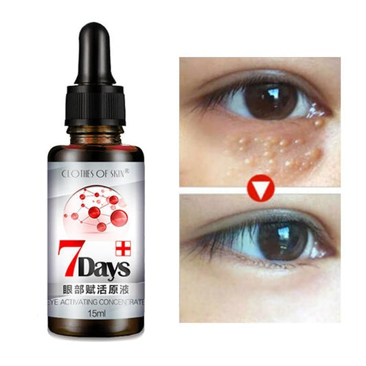 Remove Dark Circles 