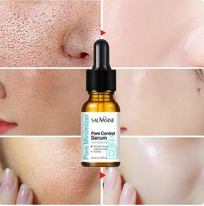 Remover Blackheads Dark Spots